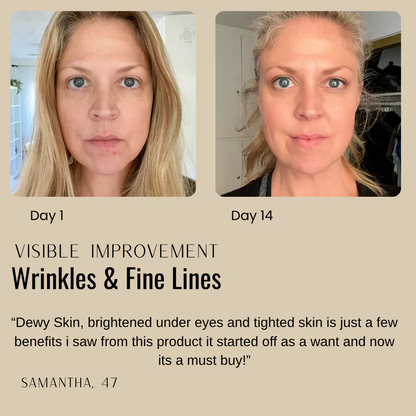 Dr. Mediko™ - Peptide Neck & Chest Tighting Cream