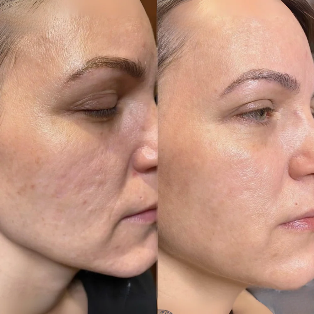 Dr. Mediko™ - Red Light Eye Cream
