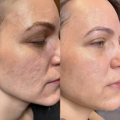 Dr. Mediko™ - Red Light Eye Cream
