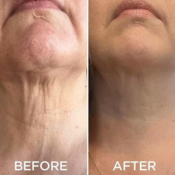 Dr. Mediko™ - Peptide Neck & Chest Tighting Cream