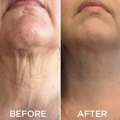 Dr. Mediko™ - Peptide Neck & Chest Tighting Cream